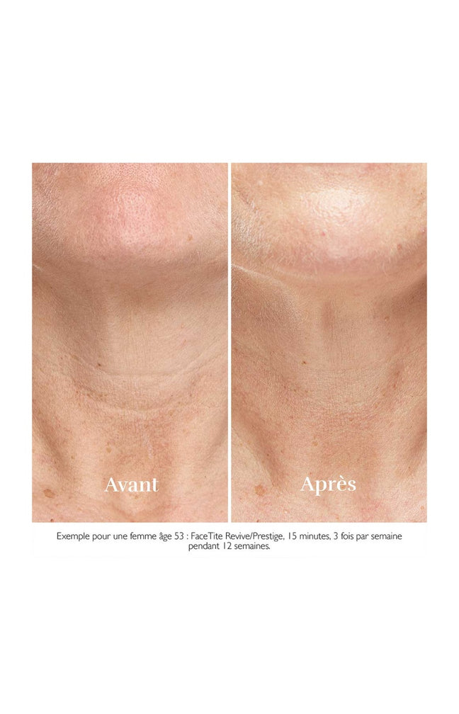 Appareil anti-âge - FaceTite Revive - Visage