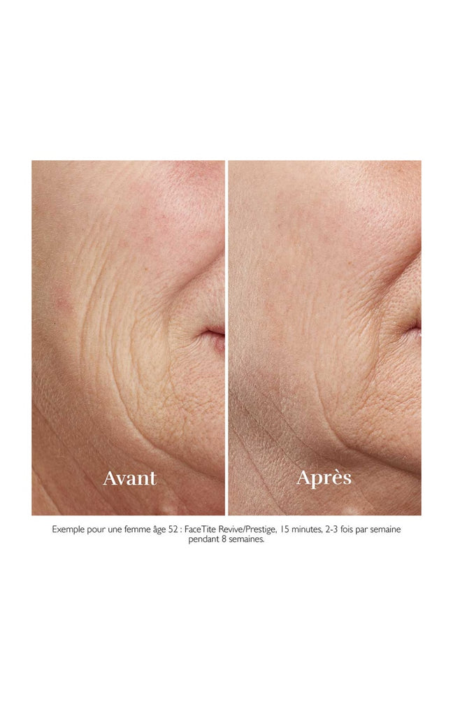 Appareil anti-âge - FaceTite Revive - Visage