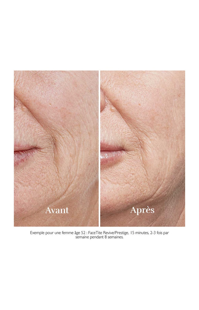 Appareil anti-âge - FaceTite Revive - Visage