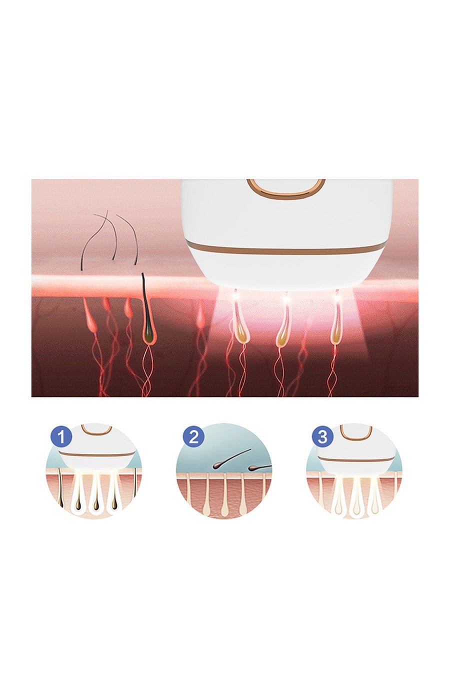 Épilateur à lumière pulsée - IPL T5S - Corps & visage
