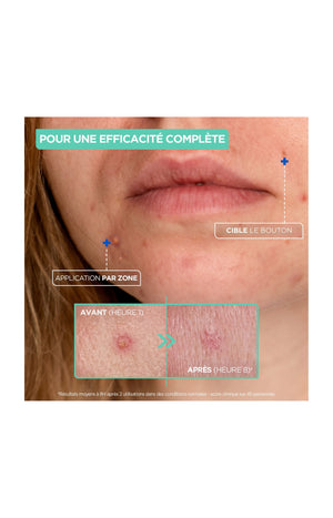 Pâte anti-boutons - Argile, acide salicylique & niacinamide - Visage