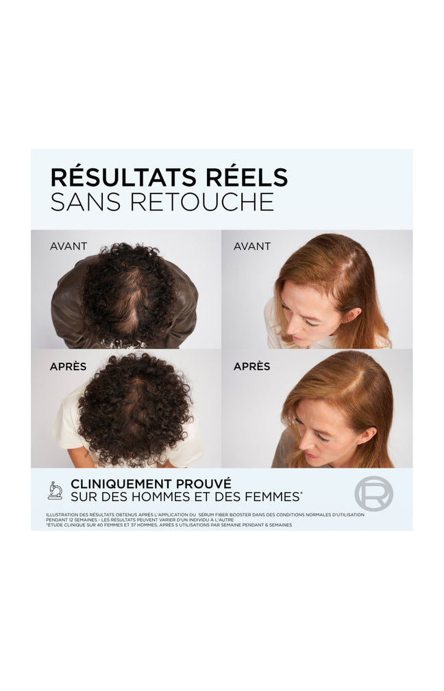 Elsève Routine Complète Anti-Chute – Le programme expert pour une chevelure plus dense et renforcée