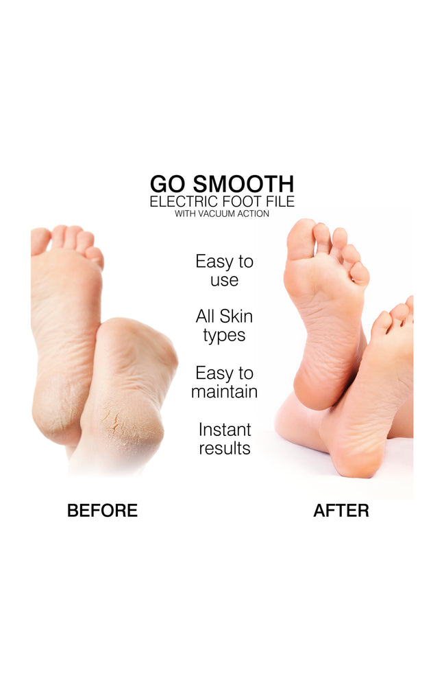 Râpe électrique pieds - Aspiration intégrée