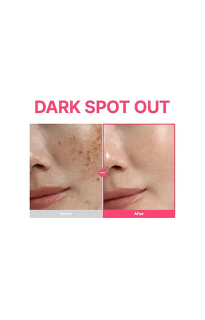 Sérum anti-taches - Niacinamide & rétinal - Visage