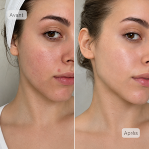 Masque LED Visage NeoDermy – Thérapie Lumière Rouge & Infrarouge