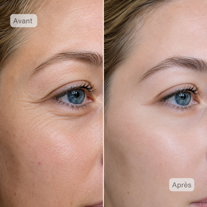 Masque LED Visage NeoDermy – Thérapie Lumière Rouge & Infrarouge