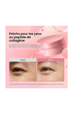 Patchs Contour des Yeux au Collagène et aux Peptides – 60 patchs