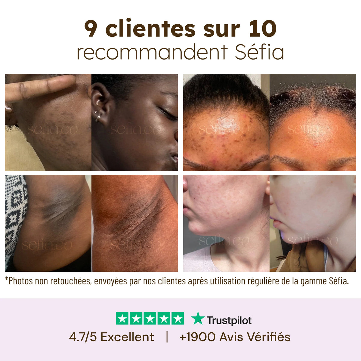 Crème Visage Hydratante au Curcuma